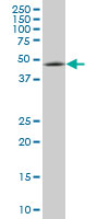 ENC1 monoclonal antibody (M03), clone 3C10. Western blot of ENC1 expression in IMR-32.