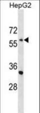 ENC1 Antibody western blot of HepG2 cell line lysates (35 ug/lane). The ENC1 antibody detected the ENC1 protein (arrow).