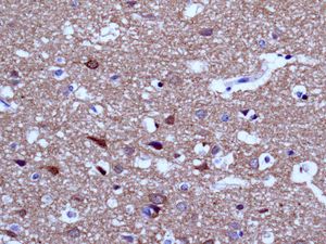 IHC of paraffin-embedded human brain tissue using anti-ENC1 antibody.