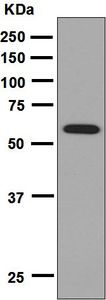 Western blot analysis on fetal brain lysate using anti-ENC1 antibody.