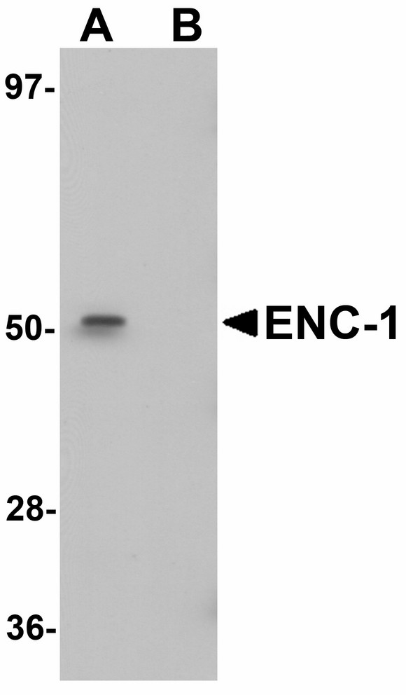 Western blot of ENC-1 in mouse kidney muscle tissue lysate with ENC-1 antibody at 1 ug/ml in (A) the absence and (B) the presence of blocking peptide.