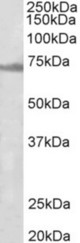 ENC1 antibody (1 ug/ml) staining of Rat Ovary lysate (35 ug protein in RIPA buffer). Primary incubation was 1 hour. Detected by chemiluminescence.