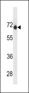 ENDOD1 Antibody western blot of A2058 cell line lysates (35 ug/lane). The ENDOD1 antibody detected the ENDOD1 protein (arrow).