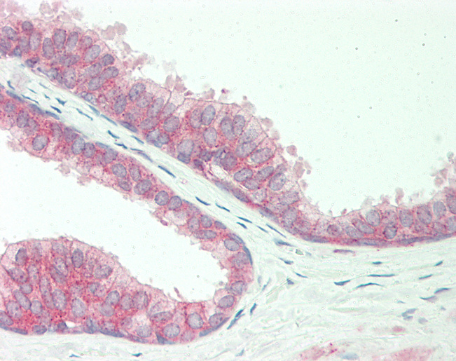 Human Prostate: Formalin-Fixed, Paraffin-Embedded (FFPE)