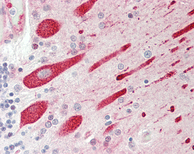 Human Brain, Cerebellum: Formalin-Fixed, Paraffin-Embedded (FFPE)