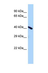 A730011L01Rik antibody LS-C146357 Western blot of Mouse Brain lysate. Antibody concentration 1 ug/ml.
