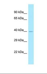 Western blot of 721_B. CSAG1 antibody dilution 1.0 ug/ml.