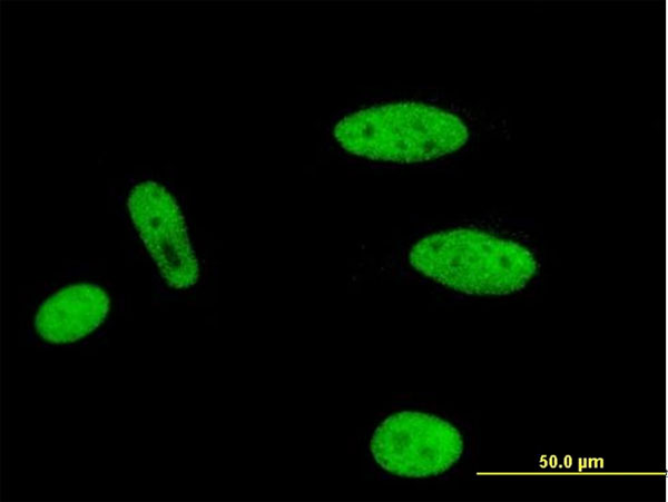 Immunofluorescence of monoclonal antibody to MLLT1 on HeLa cell . [antibody concentration 10 ug/ml]