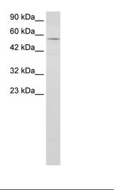 Raji Cell Lysate