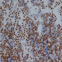 Staining of Jurkat cells with Rabbit anti-Human NNE polyclonal antibody (LS-C27288).
