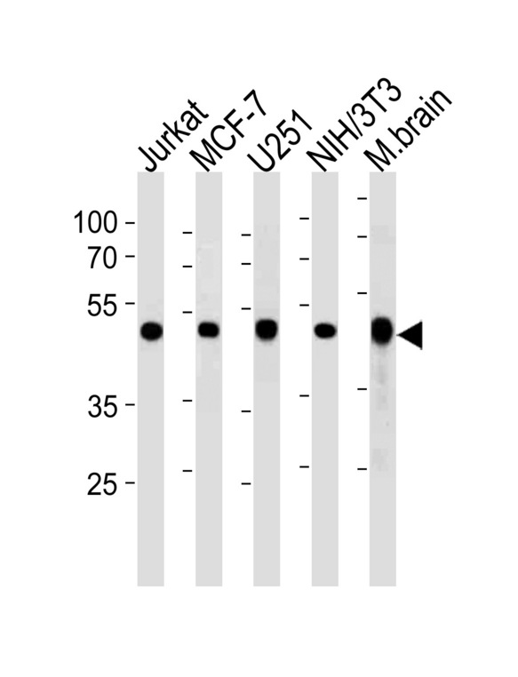 ENO1 Antibody western blot of Jurkat,MCF-7,U251,mouse NIH/3T3 cell line and mouse brain tissue lysates (35 ug/lane). The ENO1 antibody detected the ENO1 protein (arrow).