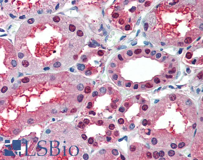 Anti-ENO1 antibody IHC of human kidney. Immunohistochemistry of formalin-fixed, paraffin-embedded tissue after heat-induced antigen retrieval. Antibody LS-B6703 concentration 5 ug/ml.