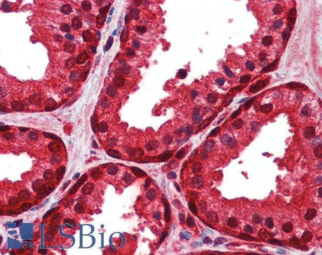 Anti-ENO1 antibody IHC of human prostate. Immunohistochemistry of formalin-fixed, paraffin-embedded tissue after heat-induced antigen retrieval. Antibody LS-B6703 concentration 5 ug/ml.
