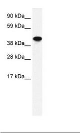 Fetal Intestine Lysate.