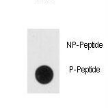 Dot blot of anti-Phospho-NSE-pY236 Antibody on nitrocellulose membrane. 50ng of Phospho-peptide or Non Phospho-peptide per dot were adsorbed. Antibody working concentrations are 0.5ug per ml.