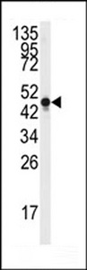 Western blot of anti-NSE Antibody (Y236) in Y79 cell line lysates (35 ug/lane). NSE (arrow) was detected using the purified antibody.