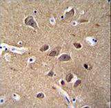 NSE Antibody (Y25) immunohistochemistry of formalin-fixed and paraffin-embedded human brain tissue followed by peroxidase-conjugated secondary antibody and DAB staining.
