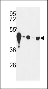 Western blot of NSE-Y25 Antibody in mouse cerebellum tissue and Y79, HepG2, Jurkat, CEM cell line lysates (35 ug/lane). NSE (arrow) was detected using the purified antibody.