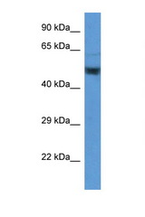ENO2 / NSE antibody LS-C135880 Western blot of Placenta lysate. Antibody concentration 1 ug/ml.
