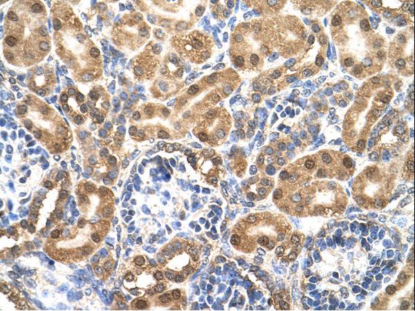 ENO3 antibody LS-C81180 was used in IHC to stain formalin-fixed, paraffin-embedded human kidney.