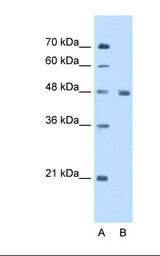 Lane A: Marker. Lane B: HepG2 cell lysate. Antibody concentration: 5.0 ug/ml. Gel concentration: 12%.