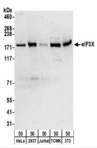Detection of Human and Mouse eIF3X by Western Blot. Samples: Whole cell lysate (50 ug) from HeLa, 293T, Jurkat, mouse TCMK-1, and mouse NIH3T3 cells. Antibodies: Affinity purified rabbit anti-eIF3X antibody used for WB at 0.1 ug/ml. Detection: Chemiluminescence with an exposure time of 75 seconds.