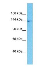 Western blot of CLUH Antibody with MDA-MB-435s Whole Cell lysate.