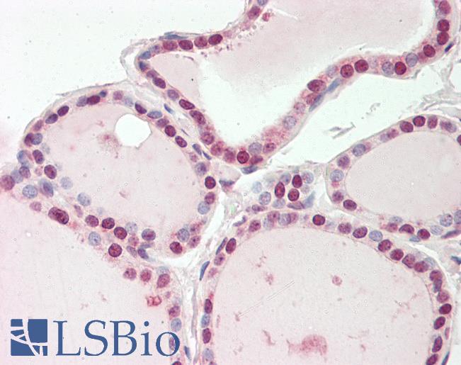 Human Thyroid: Formalin-Fixed, Paraffin-Embedded (FFPE)
