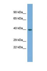 Western blot of Human Fetal Muscle. ENOSF1 antibody dilution 1.0 ug/ml.