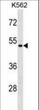 ENOSF1 Antibody western blot of K562 cell line lysates (35 ug/lane). The ENOSF1 antibody detected the ENOSF1 protein (arrow).