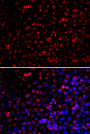 Immunofluorescence blot of U20S cell using ENOX2 antibody. Blue: DAPI for nuclear staining.