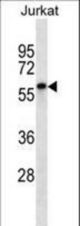 ENOX2 Antibody western blot of Jurkat cell line lysates (35 ug/lane). The ENOX2 antibody detected the ENOX2 protein (arrow).