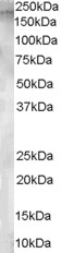 Antibody staining (1 ug/ml) of human testis lysate (RIPA buffer, 30 ug total protein per lane). Primary incubated for 1 hour. Detected by Western blot of chemiluminescence.