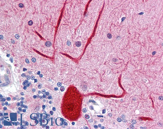Anti-ENPEP antibody IHC of human brain, cerebellum. Immunohistochemistry of formalin-fixed, paraffin-embedded tissue after heat-induced antigen retrieval. Antibody LS-B4216 concentration 10 ug/ml.