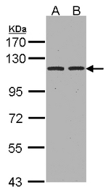 Sample(30 ug whole cell lysate). A: Hep G2. B: HeLa S3. 7.5% SDS PAGE. ENPEP antibody diluted at 1:1000.