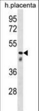 CLUL1 Antibody western blot of human placenta tissue lysates (35 ug/lane). The CLUL1 antibody detected the CLUL1 protein (arrow).