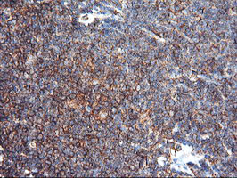 IHC of paraffin-embedded Human lymphoma tissue using anti-ENPEP mouse monoclonal antibody. (Heat-induced epitope retrieval by 10mM citric buffer, pH6.0, 100C for 10min).