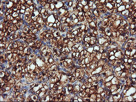 IHC of paraffin-embedded Carcinoma of Human kidney tissue using anti-ENPEP mouse monoclonal antibody. (Heat-induced epitope retrieval by 10mM citric buffer, pH6.0, 100C for 10min).
