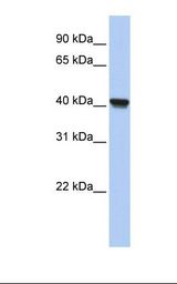 Fetal lung lysate. Antibody concentration: 1.0 ug/ml. Gel concentration: 12%.
