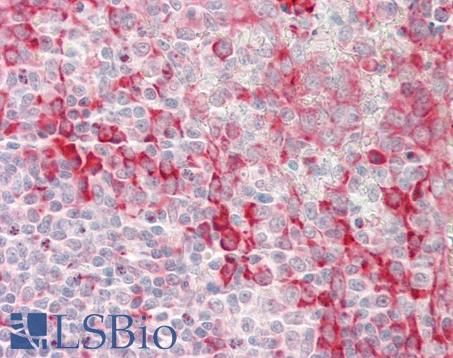 Human Tonsil: Formalin-Fixed, Paraffin-Embedded (FFPE)