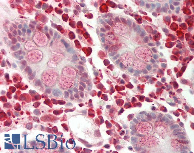 Human Colon: Formalin-Fixed, Paraffin-Embedded (FFPE)