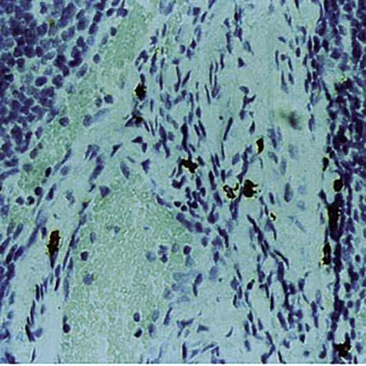 Formalin-fixed, paraffin-embedded human tonsil stained with Mast Cell Chymase antibody LS-C95542.