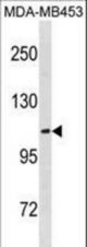 ENPP3 Antibody western blot of MDA-MB453 cell line lysates (35 ug/lane). The ENPP3 antibody detected the ENPP3 protein (arrow).