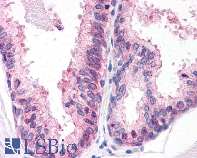 Anti-ENPP3 antibody LS-A9843 IHC of human prostate. Immunohistochemistry of formalin-fixed, paraffin-embedded tissue after heat-induced antigen retrieval.