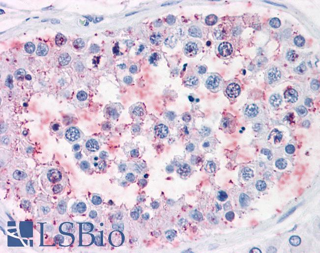 Anti-ENPP3 antibody LS-A9197 IHC of human testis. Immunohistochemistry of formalin-fixed, paraffin-embedded tissue after heat-induced antigen retrieval.