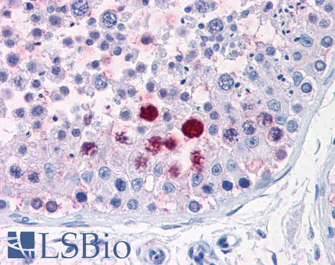 Anti-ENPP3 antibody LS-A9196 IHC of human testis. Immunohistochemistry of formalin-fixed, paraffin-embedded tissue after heat-induced antigen retrieval.