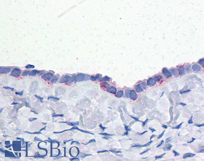 Anti-ENPP3 antibody LS-A9196 IHC of human ovary. Immunohistochemistry of formalin-fixed, paraffin-embedded tissue after heat-induced antigen retrieval.