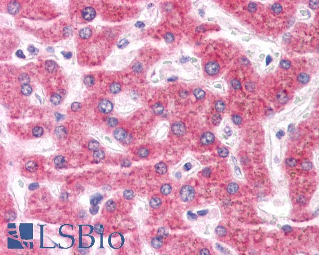 Anti-ENPP3 antibody LS-A9842 IHC of human liver. Immunohistochemistry of formalin-fixed, paraffin-embedded tissue after heat-induced antigen retrieval.