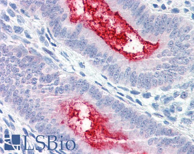 Anti-ENPP3 antibody LS-A9842 IHC of human uterus. Immunohistochemistry of formalin-fixed, paraffin-embedded tissue after heat-induced antigen retrieval.