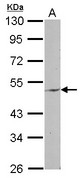 Sample (30 ug of whole cell lysate) A: MCF-7 10% SDS PAGE ENPP6 antibody diluted at 1:1000